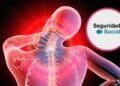 ilustracion dolor fibromialgia columna cuello pension completa seguridad social.