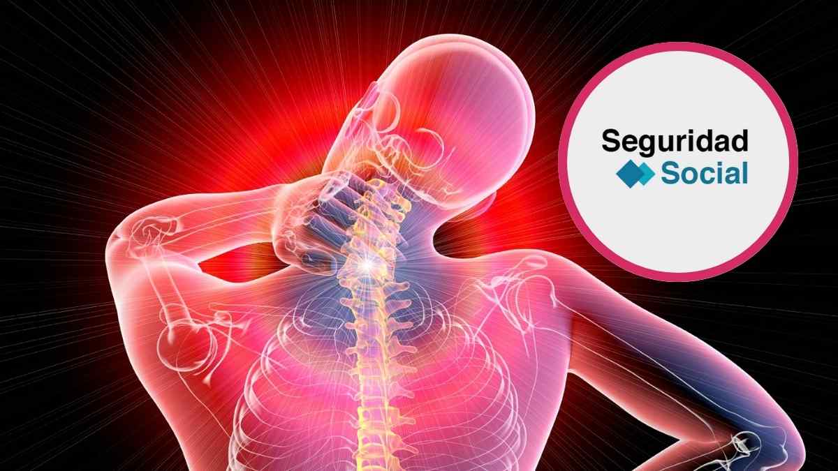 ilustracion dolor fibromialgia columna cuello pension completa seguridad social.