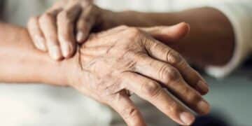 Manos con temblores por Parkinson, pensión 100% Seguridad Social.