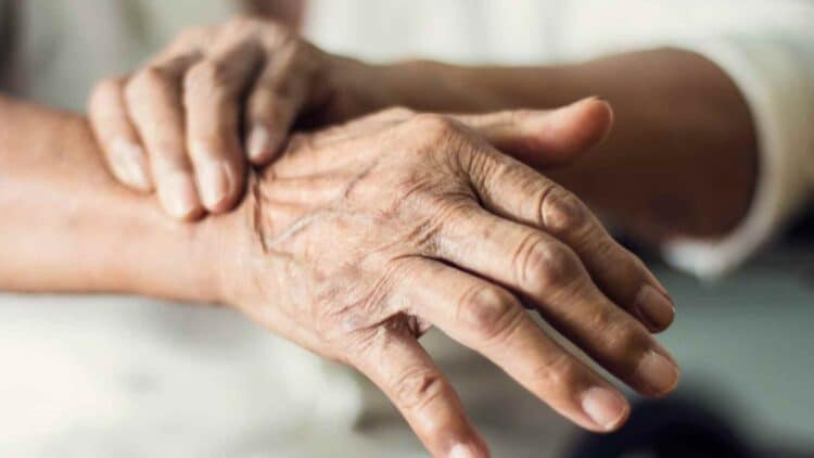 Manos con temblores por Parkinson, pensión 100% Seguridad Social.