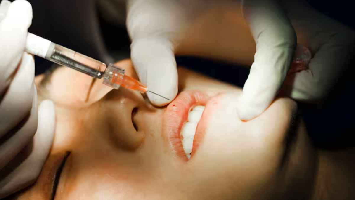 Infiltración de ácido hialurónico en labios en una clínica estética de Leganés investigada por intrusismo