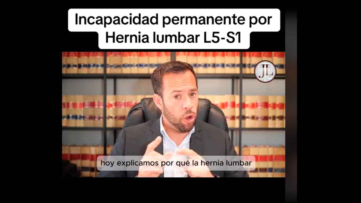 Incapacidad permanente por dolor de espalda