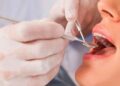 La Unión Europea prohibirá a los dentistas uno de sus procedimientos más comunes.