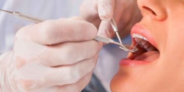 La Unión Europea prohibirá a los dentistas uno de sus procedimientos más comunes.